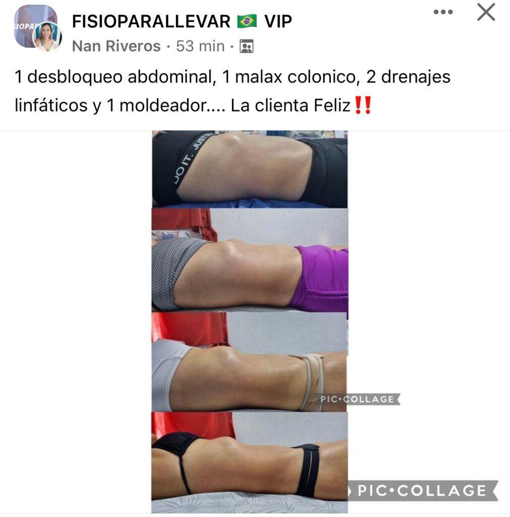 "Aplicación de técnica de drenaje linfático brasileño en zona abdominal durante práctica del curso"